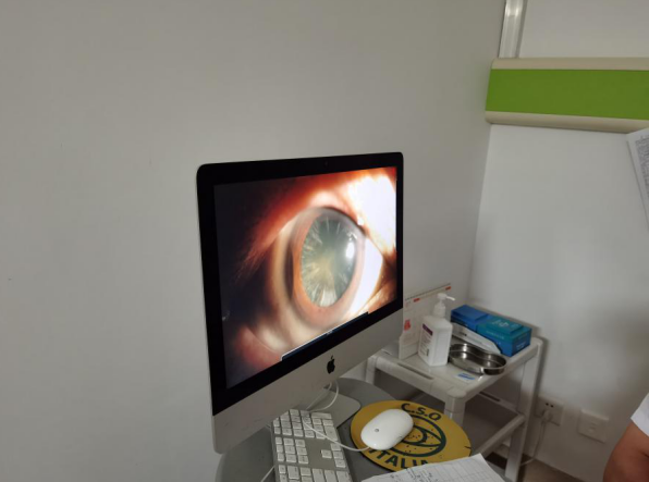 白內障手術(shù)