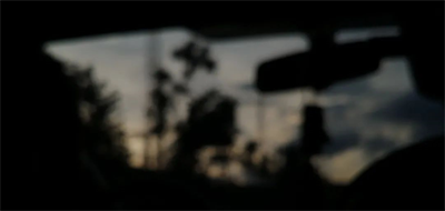 白內障手術(shù)