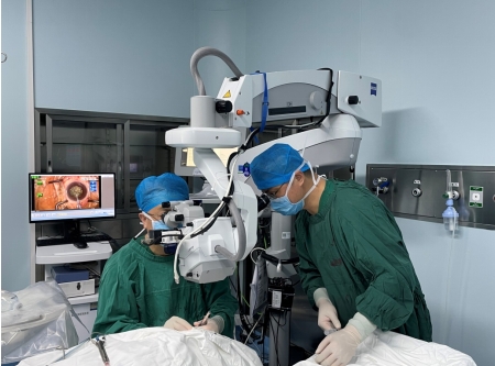 白內障手術(shù)